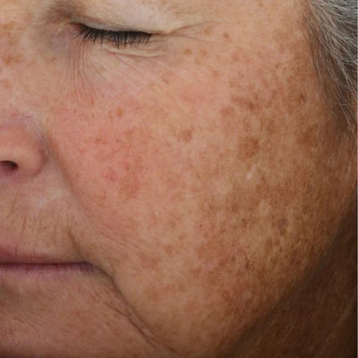 A-LUMINATE Brightening Serum™